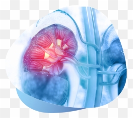 Kidney And Ureter Stones U2013 Desert Mountain Urology - Background png