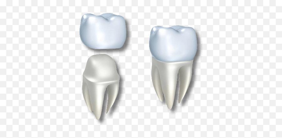 Dental Crowns In El Paso Tx Best Teeth Sol - Coronas Dentales Png,Tooth Png