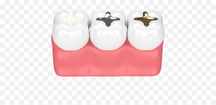 Dental Fillings Alta Austin Tx - Types Of Dental Filling Png,Icon Dental Unfilled Resin