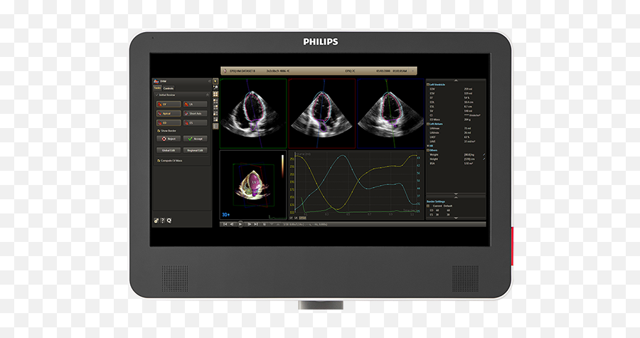 Heartmodel 3d Echocardiography Philips Healthcare - Philips Heart Model Png,3d Heart Png