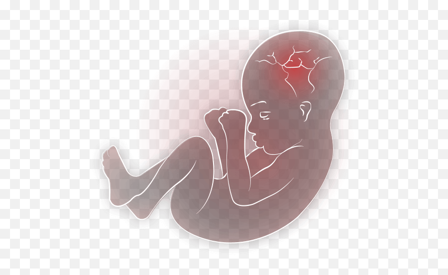 Png Transparent Baby In Womb - Baby In Womb Transparent,Fetus Png