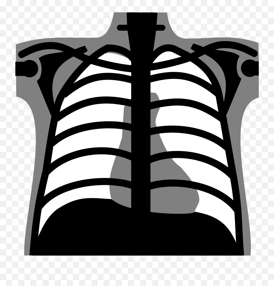 Library Of Chest Xray Image Transparent Png Files - Chest X Ray Png,Chest Png