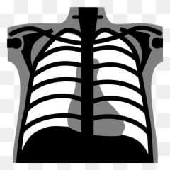 Library Of Chest Xray Image Transparent Png Files - Chest X Ray Png,Chest Png
