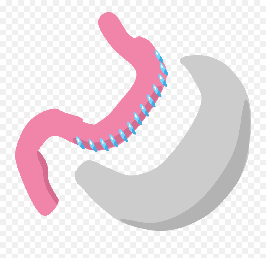 Sleeve Gastrectomy - Wikipedia Bariatric Surgery Png,Stomach Png