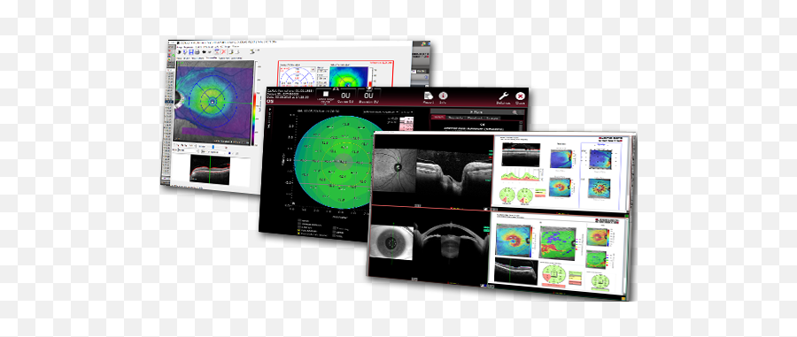 Heidelberg Eye Explorer - Data That Empowers Heidelberg Heyex 2 Heidelberg Png,Eye Icon On Computer