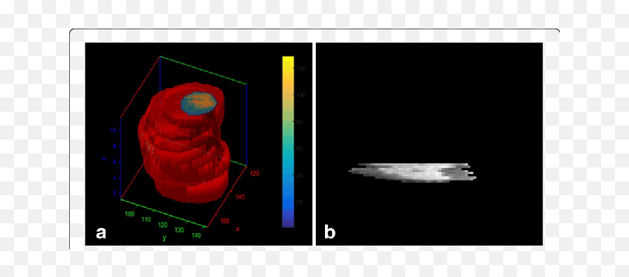 A Mr Cardiac Image 3d Heart After Scaling Along Z - Screenshot Png,3d Heart Png