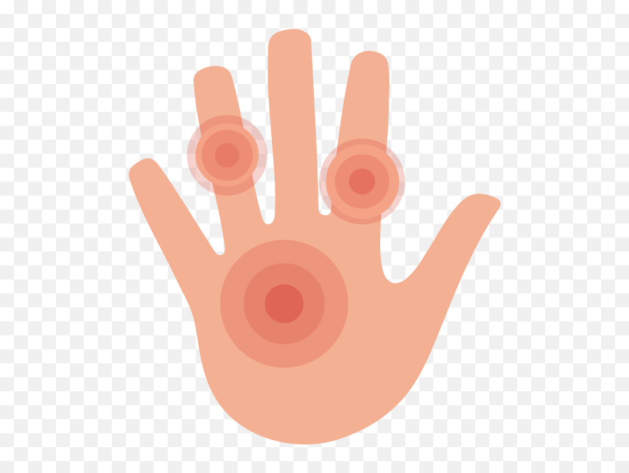 Top 11 Causes Of Hand Swelling Buoy - Sign Language Png,Eczema Icon