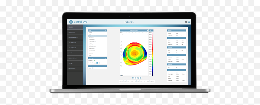 Eye Surface Profiler - The Ultimate In Ocular Topography Eaglet Eye Surface Profiler Png,Eye Icon On Computer