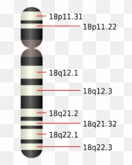 Edwards Syndrome - Wikipedia 16 png