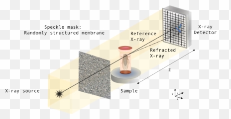 Single - Image Geometricflow Xray Speckle Tracking Coffee Table Png,Speckles Png