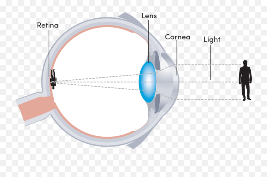 Dr Joanne Goh Laser Eye Surgeon - Circle Png,Laser Eye Png