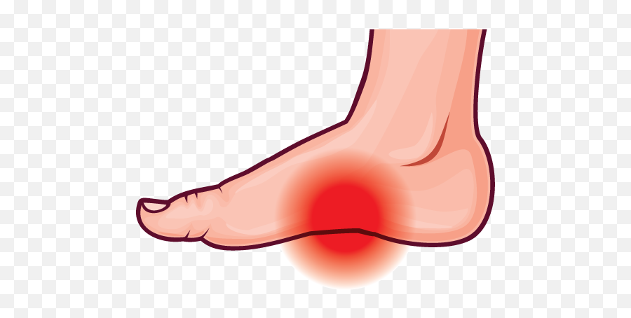 Foot Pain - Comfort Plus Shoes U0026 Footcare Uric Acid In Heel Png,Foot Png