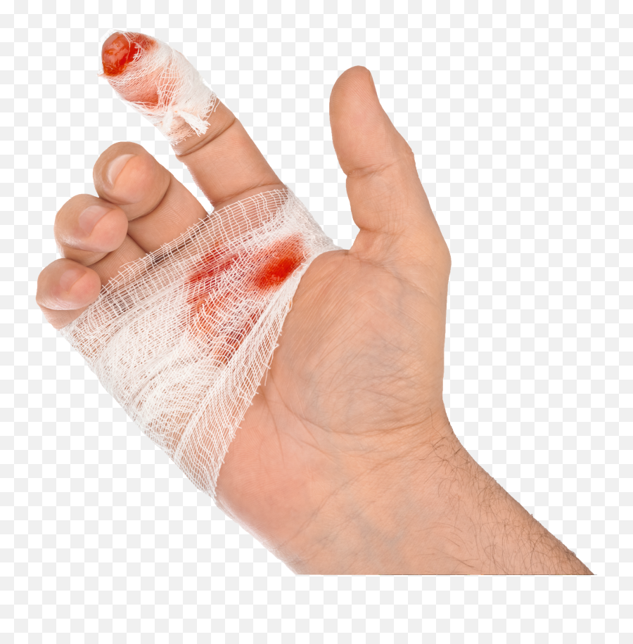 Download Steel Doctor Blade Injury Cut - Hand Injury Photos Download Png,Cut Png