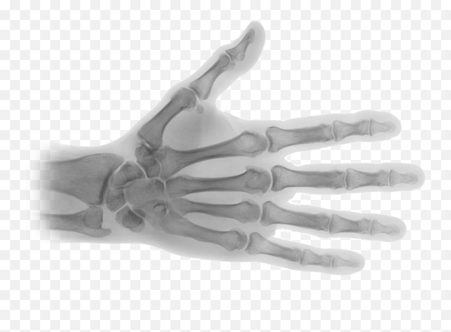 Download Hd X Ray Transparent Png - X Ray Hand Png,X Ray Png