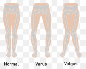 Zion Williamsons Knee Surgery - Disease Png,Zion Williamson Png