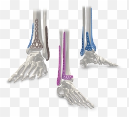 Aos - Prosthetics Mechanic Png,Fibonacci Png