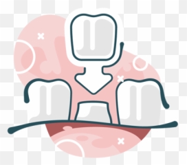 Dental Crowns Northgate Black Forest Co Ridgeline Family - Fictional Character Png,Icon Family Dentistry