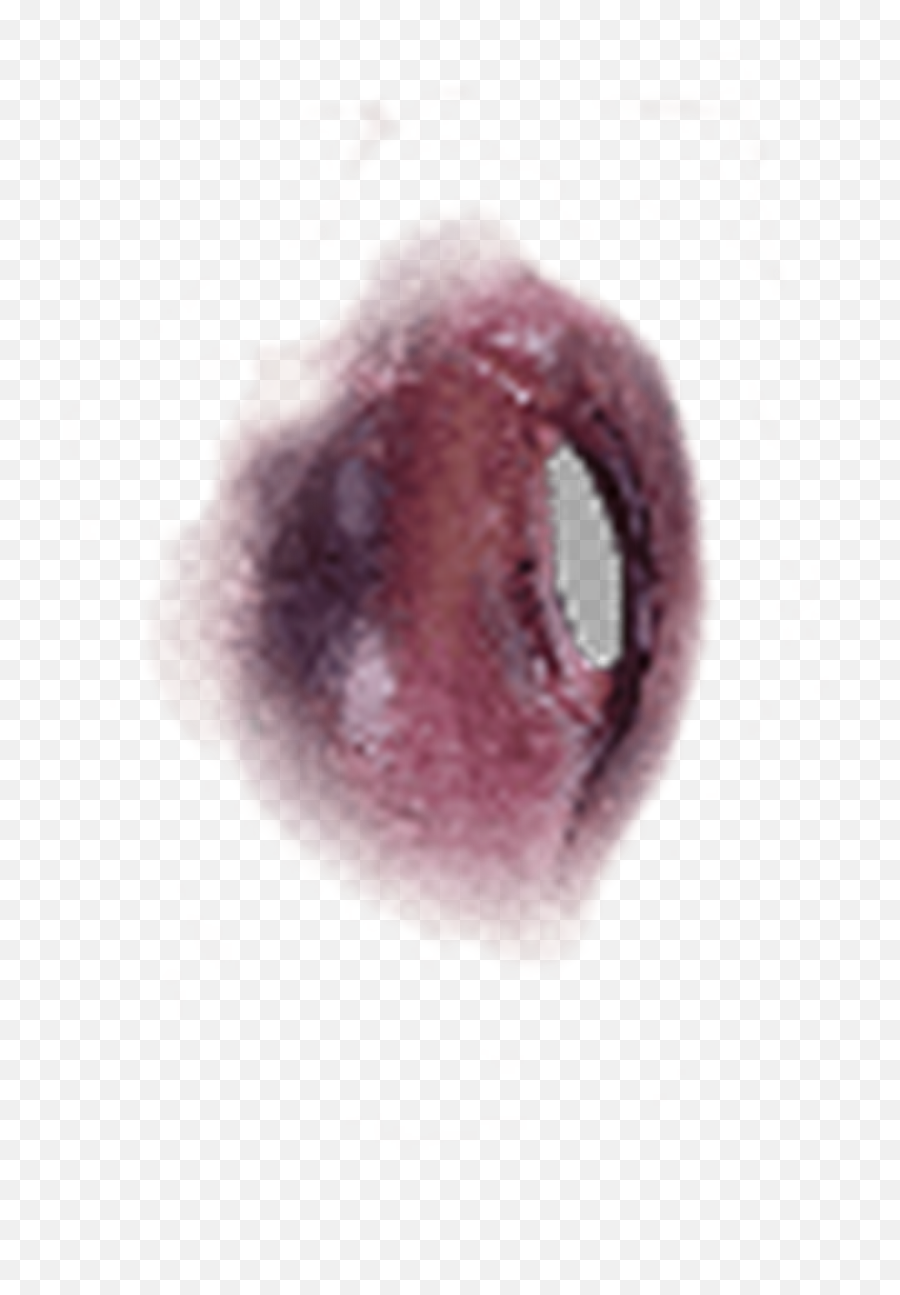 Face Bruise - Overlay Bruises Png,Bruises Png