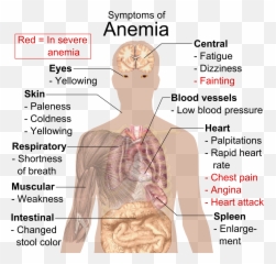 Filesymptoms Of Anemiapng - Wikimedia Commons Symptoms Of Iron Deficiency Anemia,Chest Png