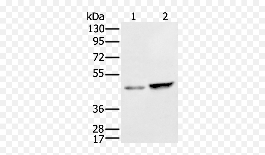 Anti - Znf24 Antibody Rabbit Znf24 Polyclonal Antibody Dot Png,Antibody Png