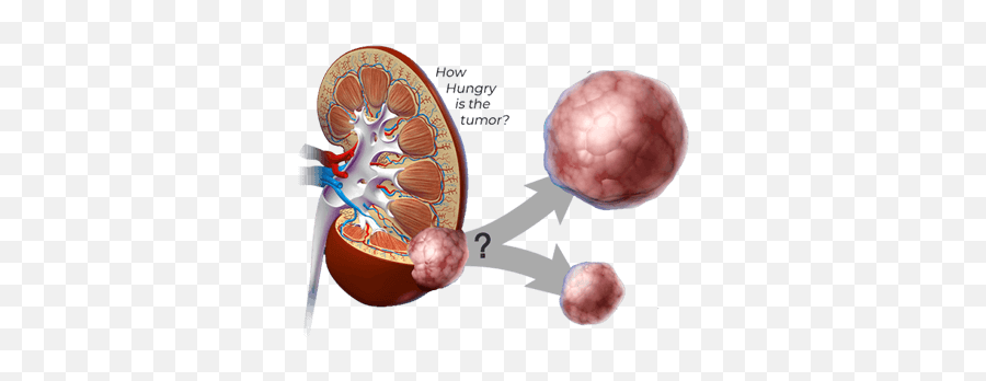 Spore Award - Utsw Kidney Cancer Program Medical Png,Spore Icon