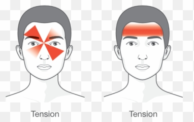 Headache Healthplus Clinics - Headache In The Front Of The Head Png,Headache Png