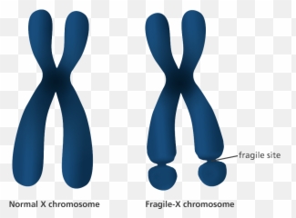 What Is Fragile - X syndrome Facts yourgenomeorg Xx Chromosome png