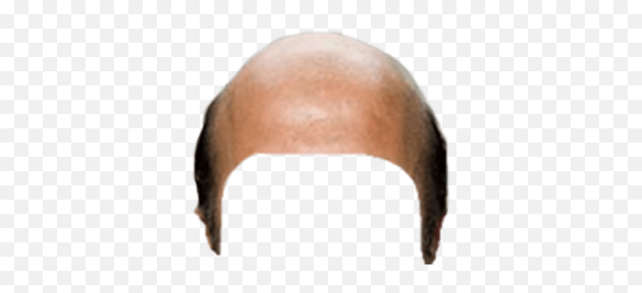 Bald Head Snapchat Filter Transparent - Bald Head Transparent Png,Bald Head Png