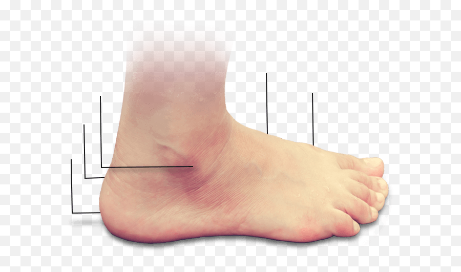 Custom Orthotics Insoles Foot Care Clinic New Png Feet