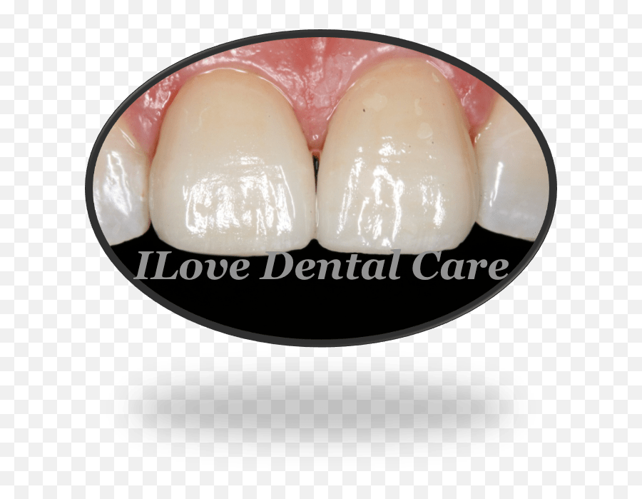 Cosmetic Dentistry U2013 Ilove Dental Care - Ugly Png,Cosmetic Dentistry Icon